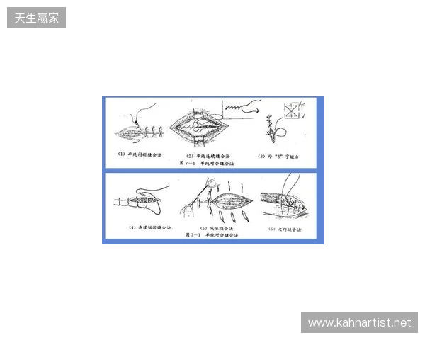 广州豹官方:杨浩眉弓伤口缝合30余针,预计5-7天后拆线 广州豹官方:杨浩眉弓伤口缝合30余针,预计5-7天后拆线